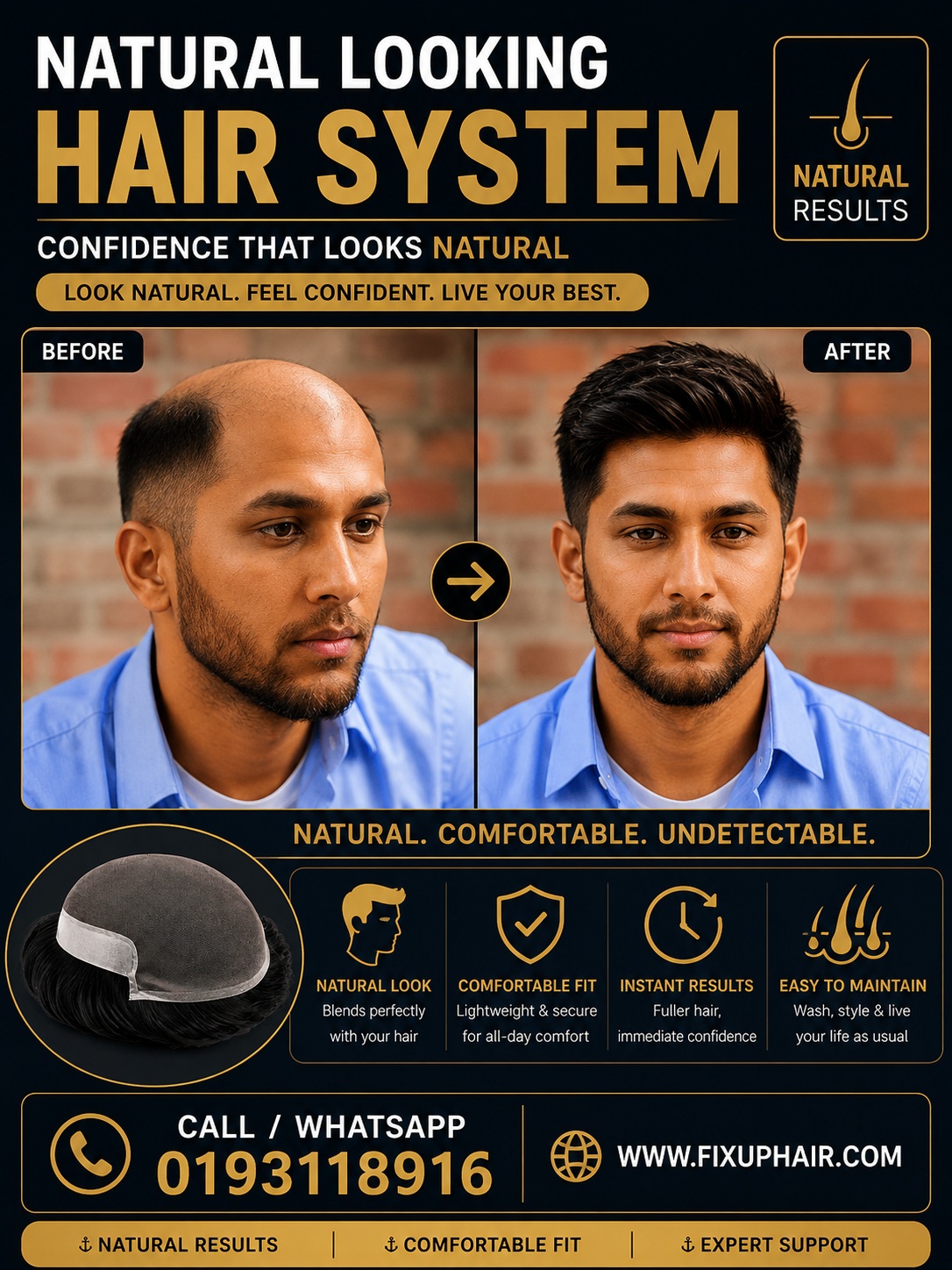 Natural Hair System Result