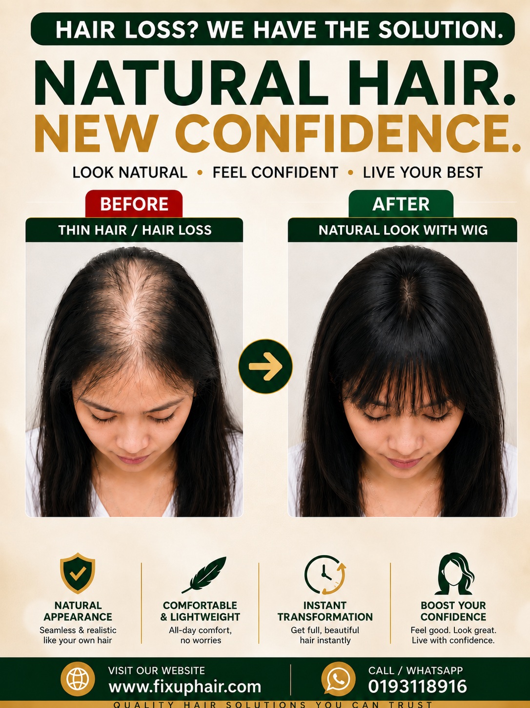 Women's Hair System